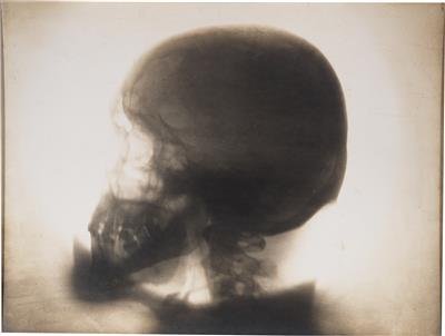 Röntgenbild, um 1900, - Tribal Art
